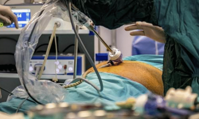 How Gastric Bypass Surgery Reduces the Risk of Obesity-Related Heart Disease