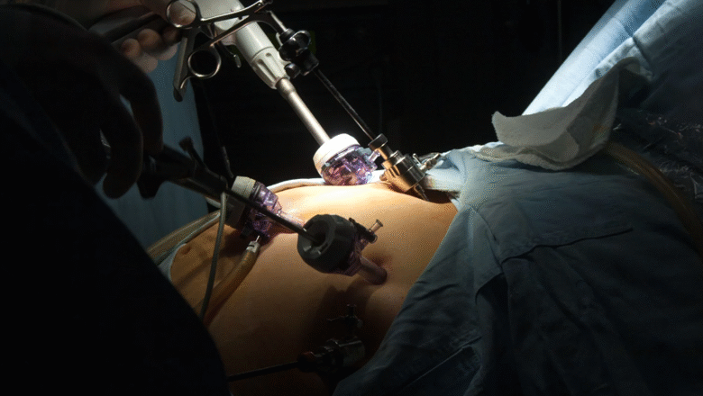 How Gastric Bypass Surgery Helps Manage Type 2 Diabetes